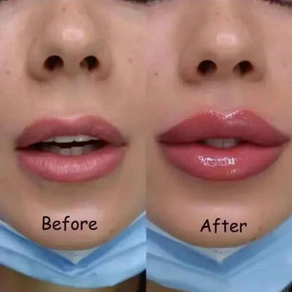 Instant Lip Plumper Oil And Gloss Serum For Volumizing Anti Wrinkle Lip Care