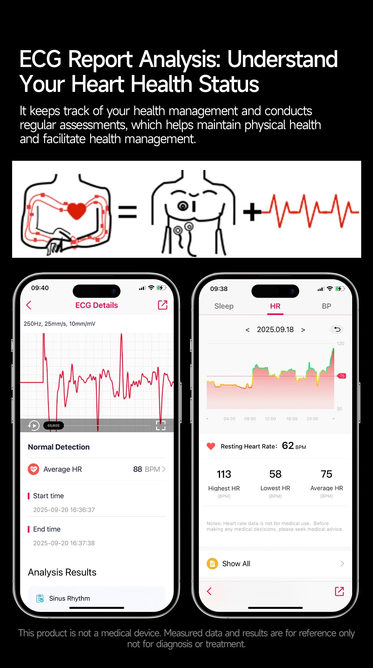 2026 New upgrade Health Check Smart Watch ECG Blood Lipid Uric Acid Body Fat BP Sport Waterproof HD Call Smart Watch Man Women