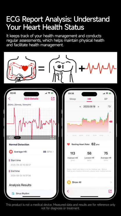 2026 New upgrade Health Check Smart Watch ECG Blood Lipid Uric Acid Body Fat BP Sport Waterproof HD Call Smart Watch Man Women