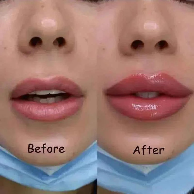 Instant Lip Plumper Oil And Gloss Serum For Volumizing Anti Wrinkle Lip Care